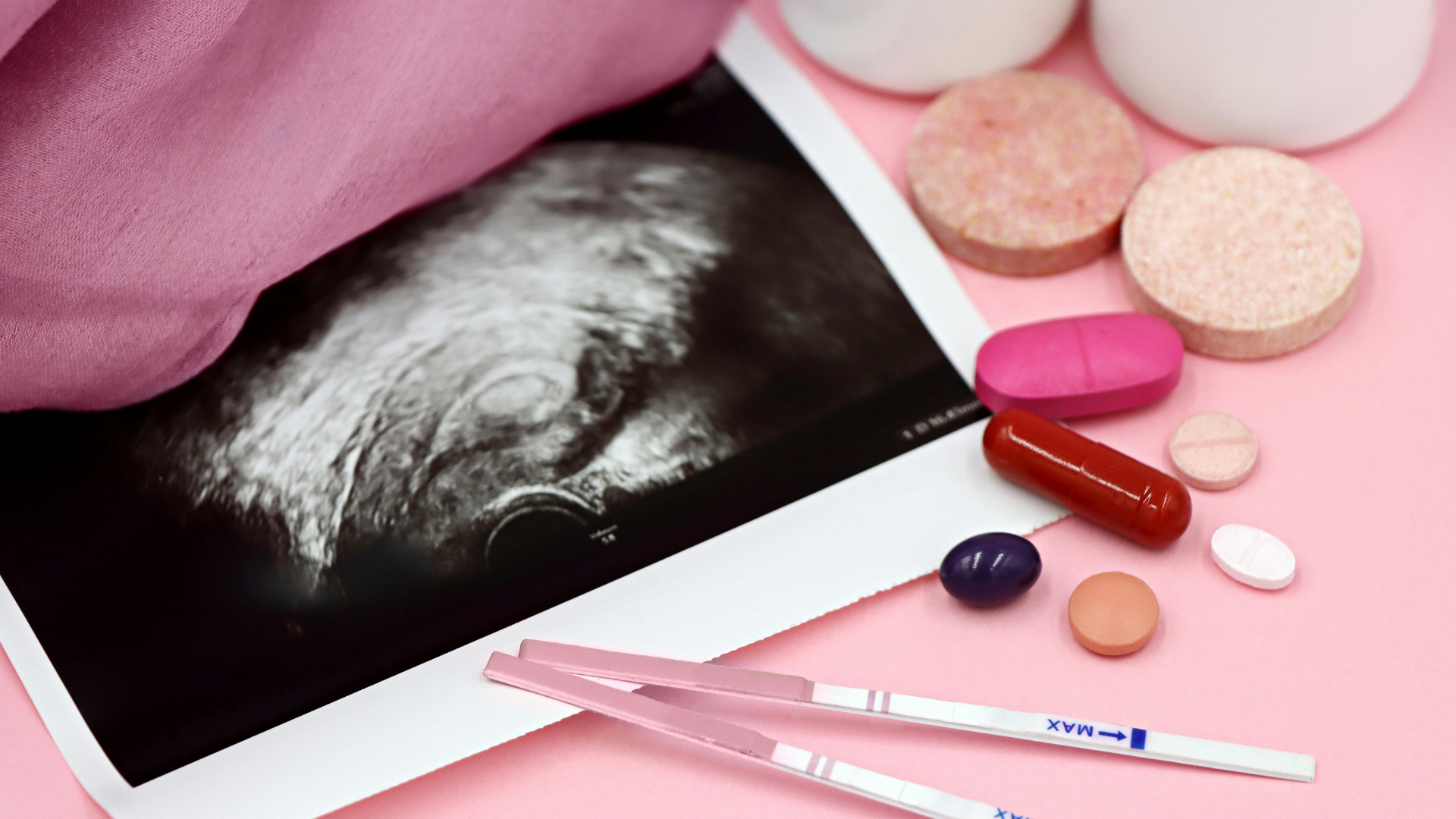 Těhotenský test, ultrazvuk miminka