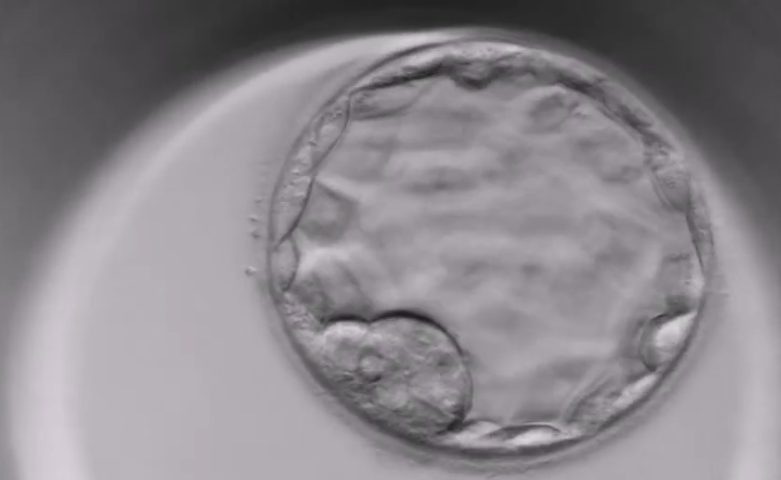 Záznam z TL Miri inkubátoru